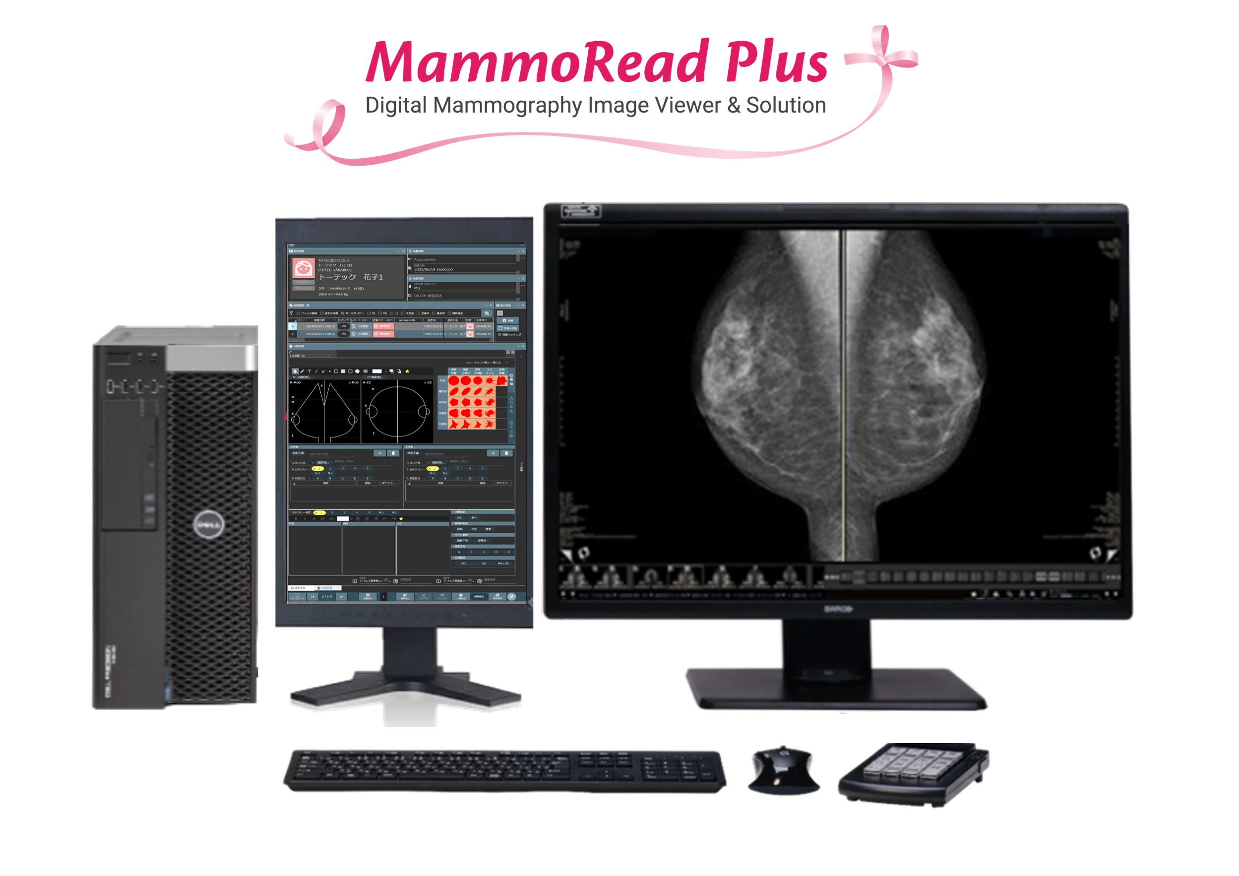 MammoRead Plus