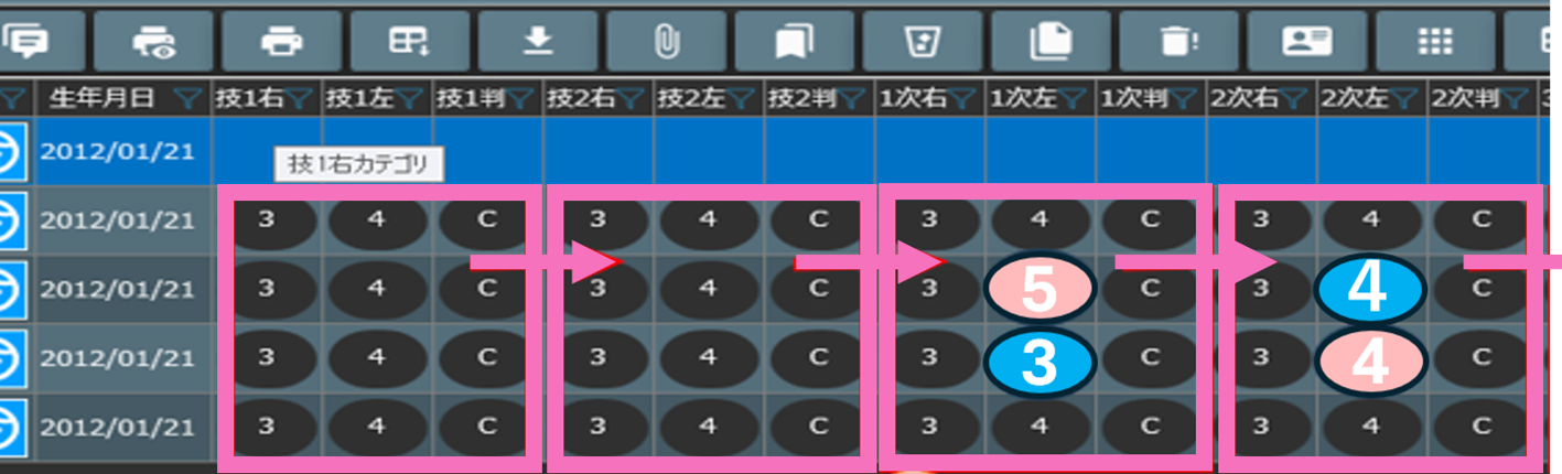 読影結果の差異をカラー表示